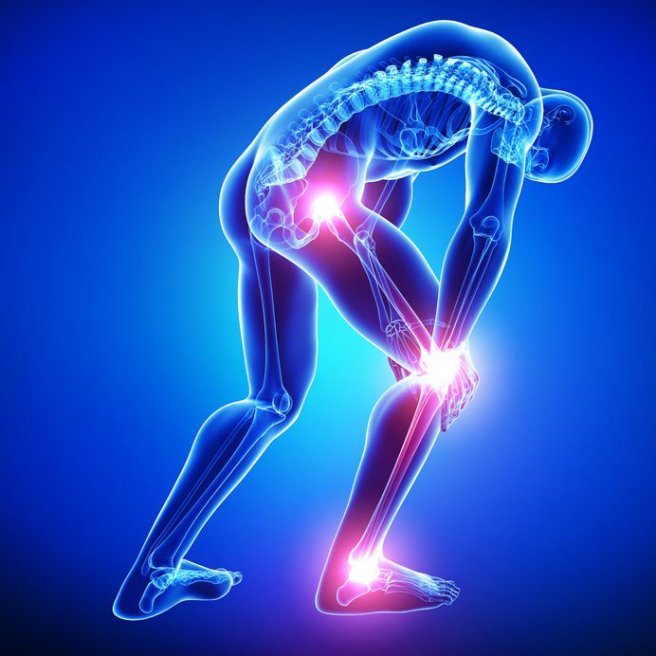 Sciatica pain can be crippling, especially if it is left to progress 